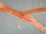 Eriophorum angustifolium root